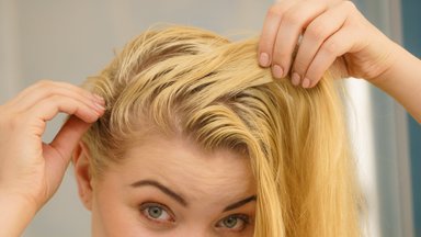 Specialistė įvardijo tikrąsias greito plaukų susiriebalavimo priežastis