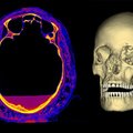 Egipto mumiją kompiuteriniu tomografu nuskenavę mokslininkai jos galvoje aptiko didžiulį darinį, pilve – kūdikį