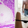 Pikantiško eksperimento metu lytiniuose organuose aptikti didžiausi malonumų centrai: stimuliacija dviem skirtingais būdais sukėlė stiprią reakciją