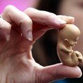 Prawnicy: Zakaz aborcji ograniczy prawa kobiet