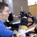 Paralyžiuotas vyras dėl naujo medicinos pasiekimo atgavo gebėjimą valdyti ranką