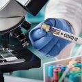Moksliniams tyrimams dėl koronaviruso pandemijos – 1,45 mln. eurų