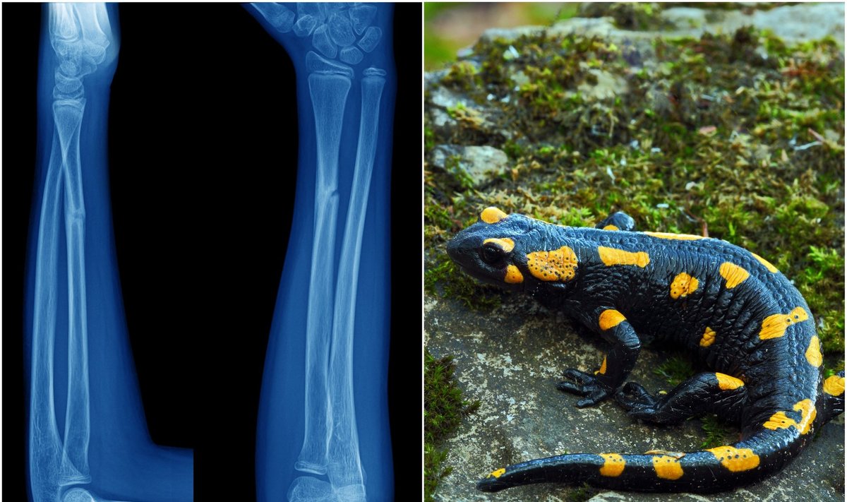 Rentgenas ir salamandra.  (DELFI montažas / Shutterstock nuotr.)