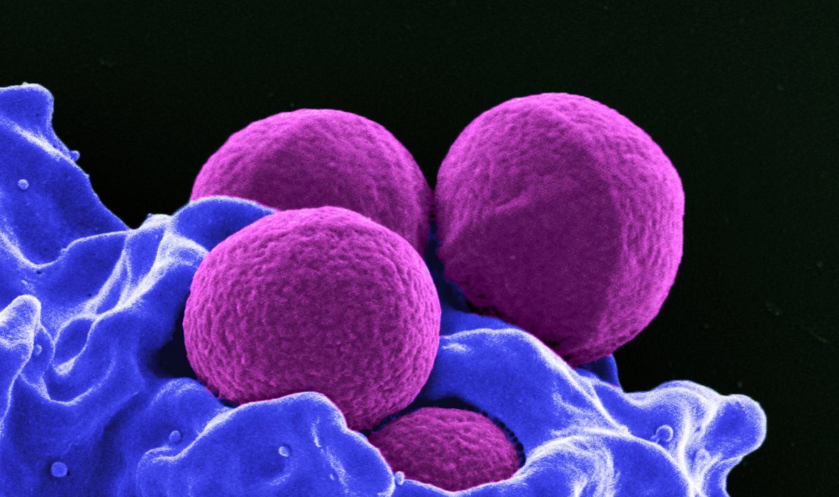 Antibiotikams atspari bakterija Staphylococcus aureus (MRSA)