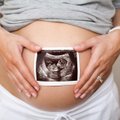 Net 2–4 proc. nėštumų susiję su įgimta vaisiaus patologija: kas nutinka tai nustačius?
