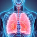 4 dažniausi rimtos plaučių ligos išsivystymą nulemiantys faktoriai