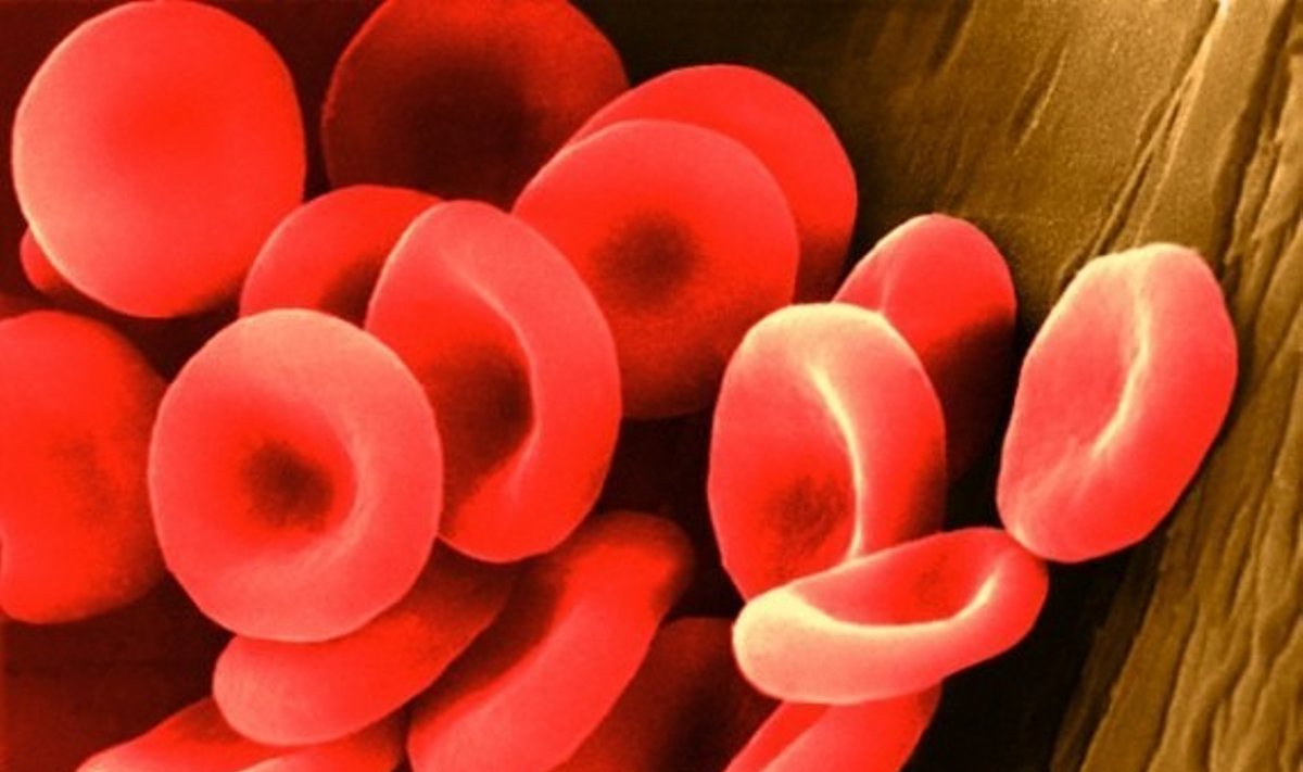 Kraujagyslės