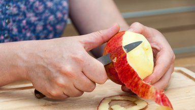 Gydytoja pasidalino mažai kam girdėta obuolių savybe: gali sumažinti net dantų ėduonį