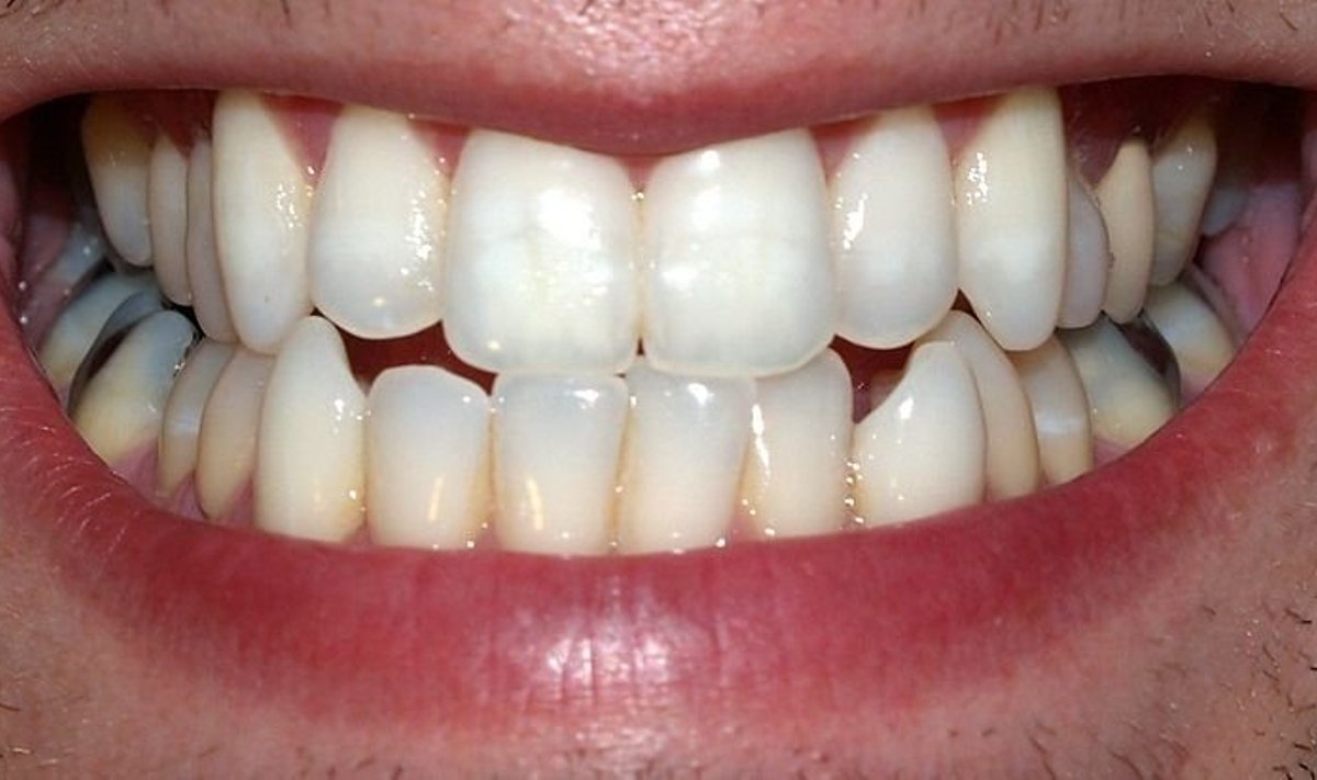 Kiek sulčių gerti, kad dantys išliktų nepažeisti? (David Shankbone nuotr. )