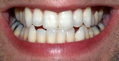 Kiek sulčių gerti, kad dantys išliktų nepažeisti? (David Shankbone nuotr. )