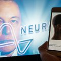 Musko įmonė „Neuralink“ kaltinama užkrėstų implantų gabenimu: galėjo kilti pavojus žmonių gyvybėms