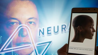 Kiek realūs Elono Musko pažadai dėti čipus į smegenis