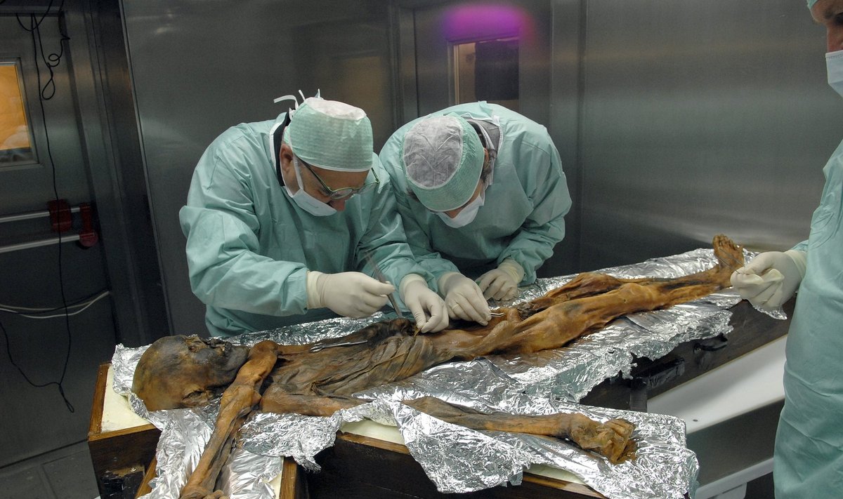 Ötzi mumija