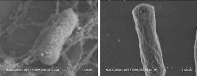 Kairėje E. Coli bakterijos kultūrą natūraliomis sąlygomis – aplink ją matosi baltymų gijos. Dešinėje - E. Coli bakterijos, paruoštos eksperimentiniam purškimui, todėl jau išplautos sūryme