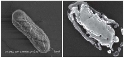 Kairėje – bakterjja po 2 val. trukmės autoklavo sterilizacijos karščiu (160 laipsnių pagal Celsijų). Dešinėje – bakterija po 0,002 sek. trukmės sterilizacijos šaltąja plazma