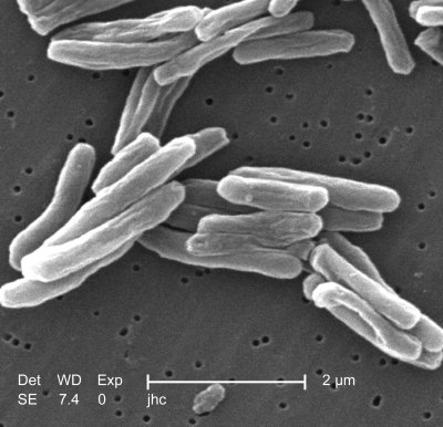 M. tuberculosis. Tuberkuliozę sukeliančios bakterijos. Wikipedia nuotr.