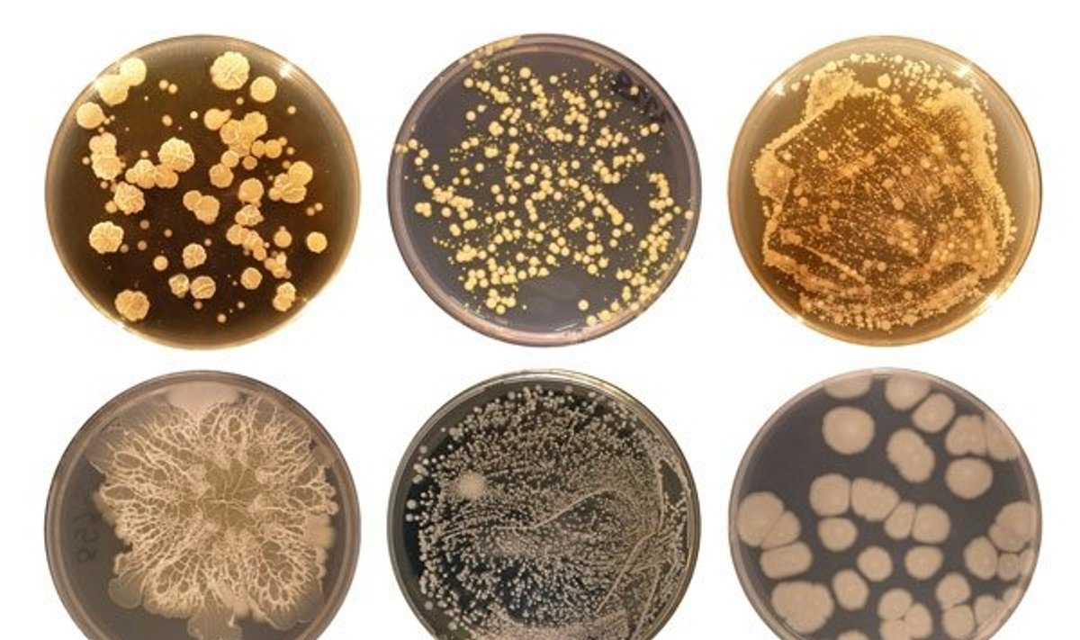 Bakterijų bioįvairovė (Belly Button Biodiversity nuotr.)