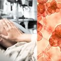 JAV plinta mirtinai pavojinga grybelinė infekcija: yra du būdai, kaip ji gali paveikti žmogaus organizmą