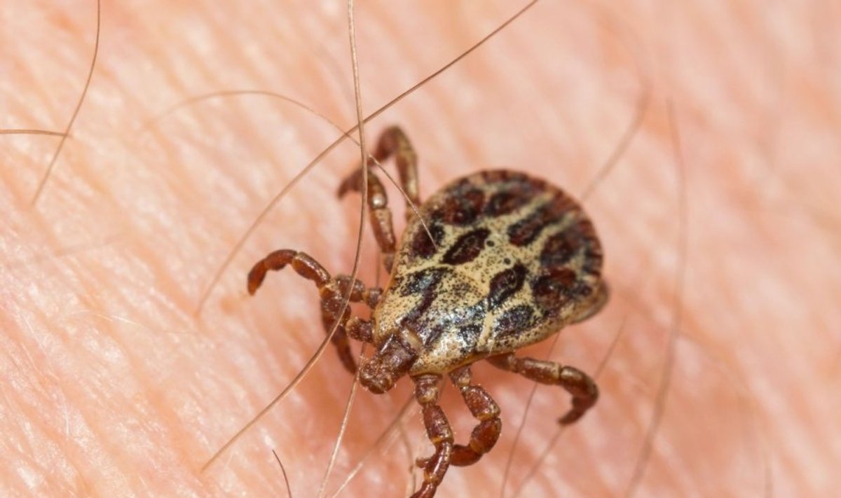 Erke Insect Kaip teisingai ištraukti įsisiurbusią erkę - Delfi sveikata